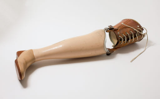 Prosthetic Leg - Prosthesis